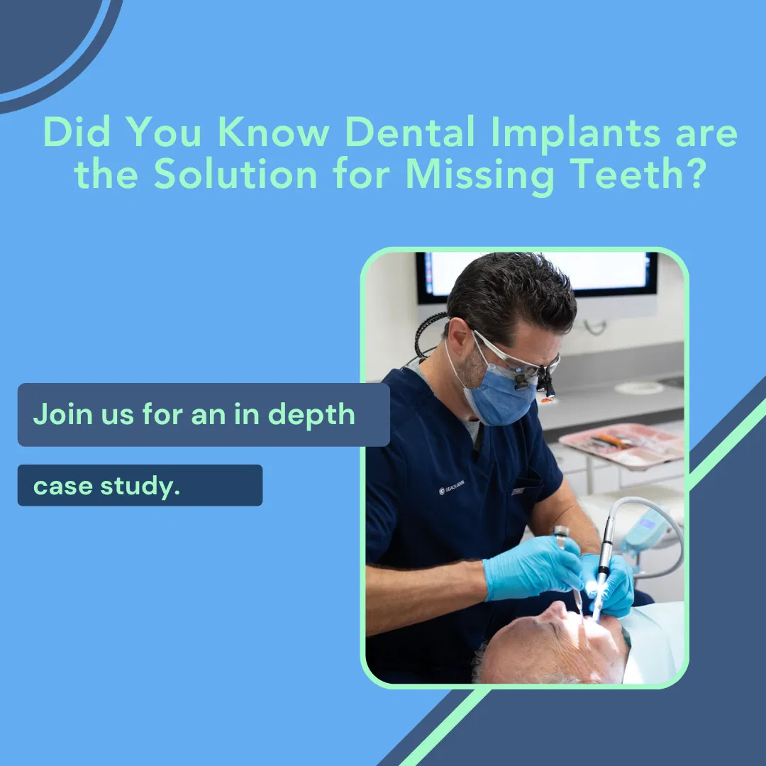 Replacement of Missing Teeth with Dental Implants